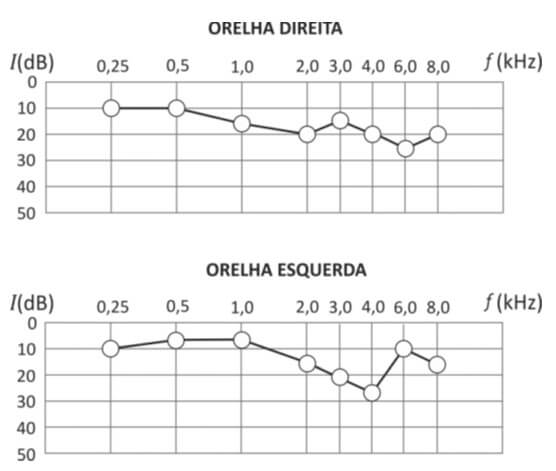 O resultado do exame de audiometria de uma pessoa mostrado nas figuras